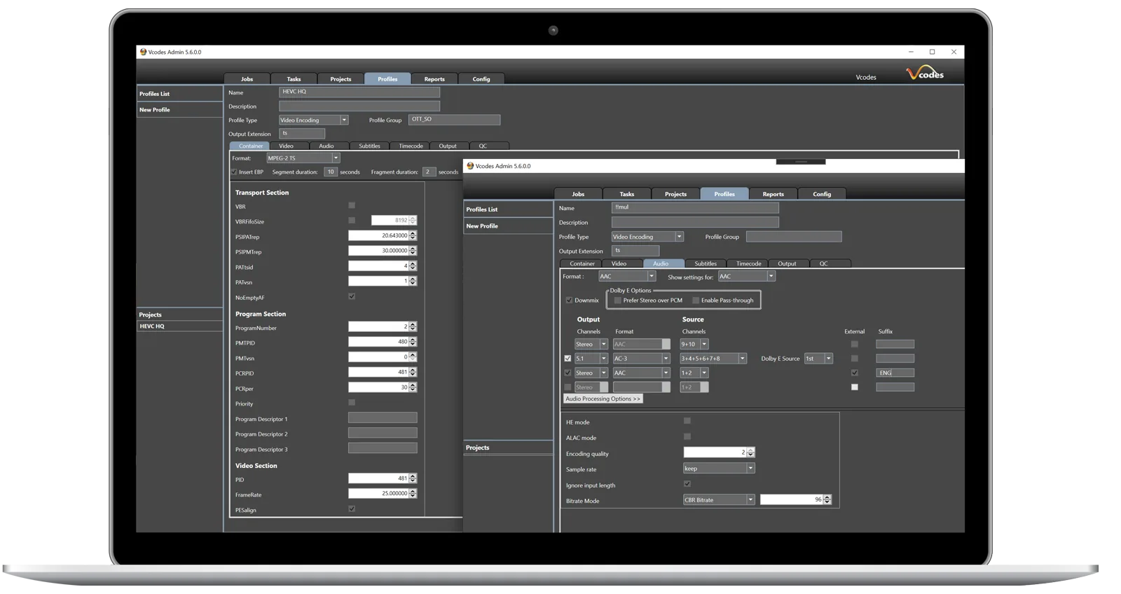 Laptop showing vCoder workflow settings for automated source analysis